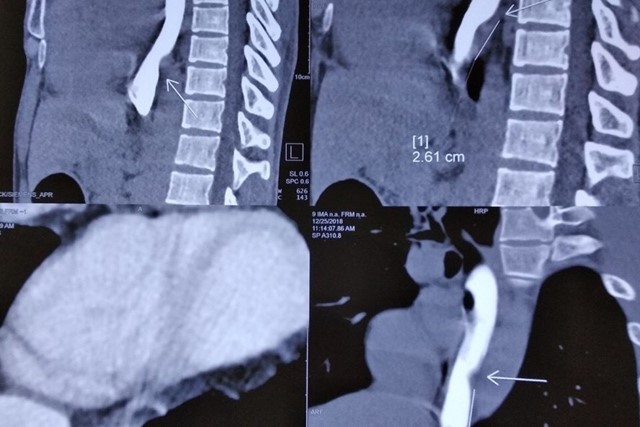 Tiêu Viêm 3D có thể ứng dụng trong lĩnh vực y tế hay không?
