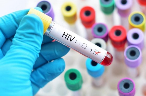 Phân biệt những triệu chứng phát ban của hiv với các bệnh khác