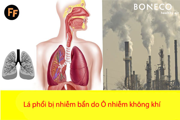 Ô nhiễm không khí có tác động ngắn hạn và dài hạn lên sức khỏe. Vậy tác động ngắn hạn và dài hạn đó là gì?
