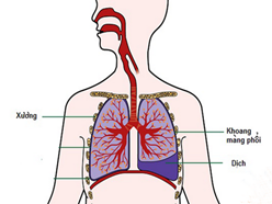 Những nguyên nhân ho ra máu trong lao phổi mà bạn cần biết